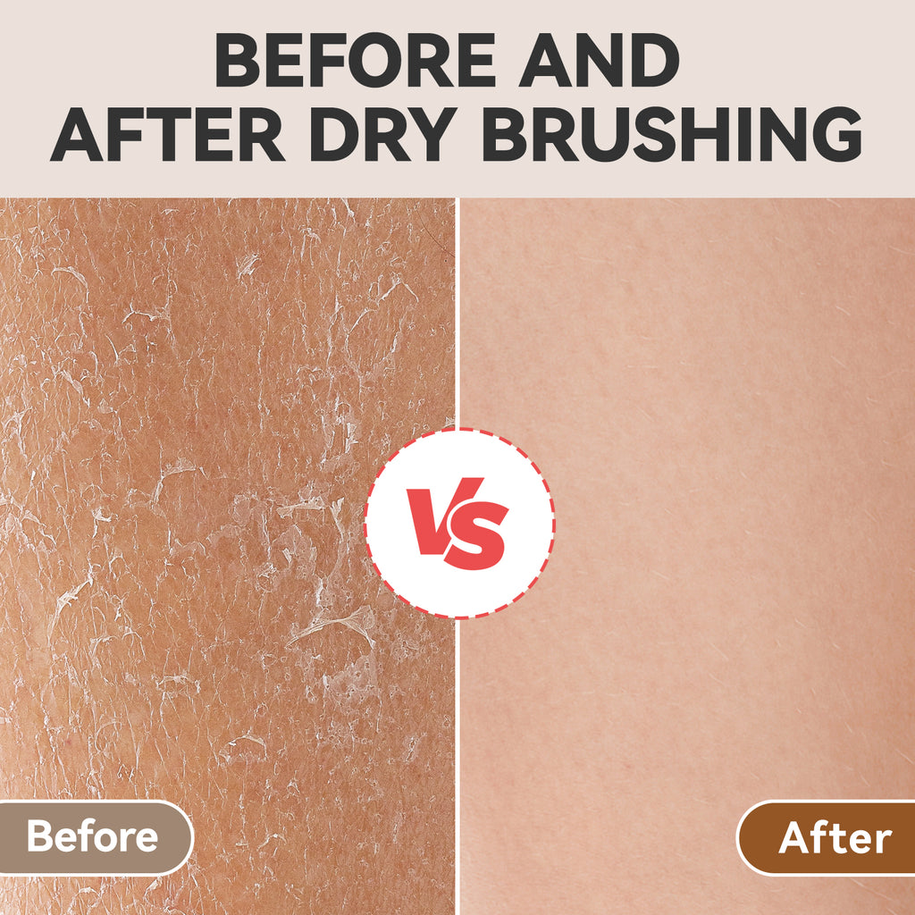 Ithyes Dry Brushing Body Brush Exfoliating Brush Natural Bristle Bath Brush for Remove Dead Skin Toxins Cellulite,Treatment,Improves Lymphatic Functions,Exfoliates,Stimulates Blood Circulation